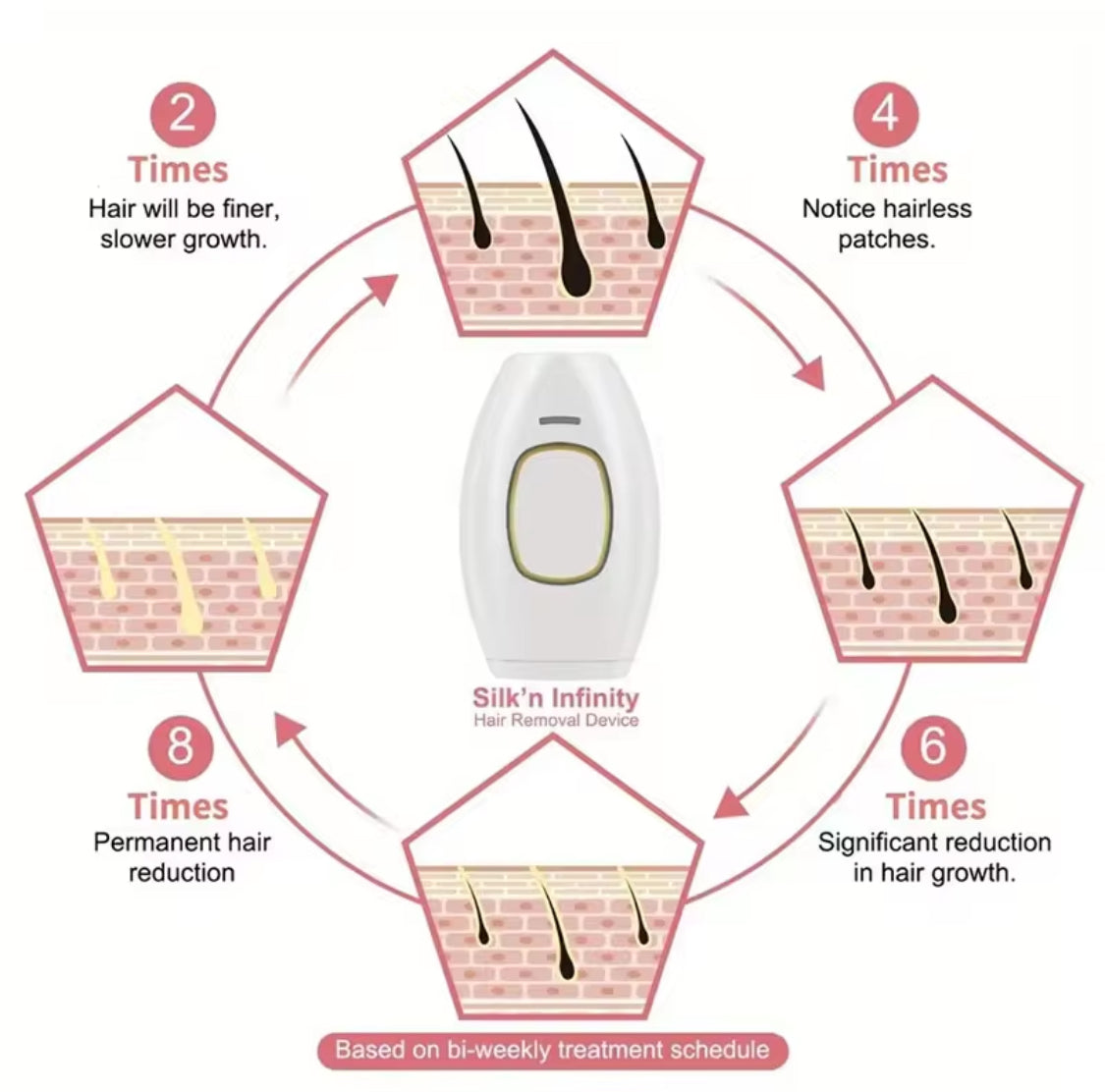Portable Hair Removal Laser Epilator, Painless Face Body Hair Removal Machine, Body Care Depilation Tool Portable Hair Removal Laser Epilator, Painless Face Body Hair Removal Machine, Body Care Depilation Tool